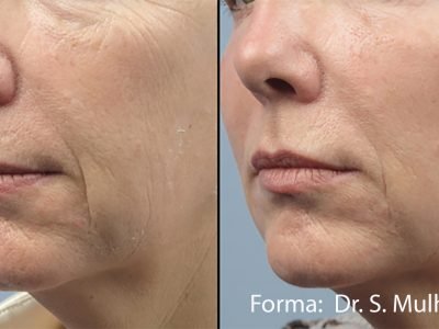 forma-before-after-dr-s-mulholland-preview-1